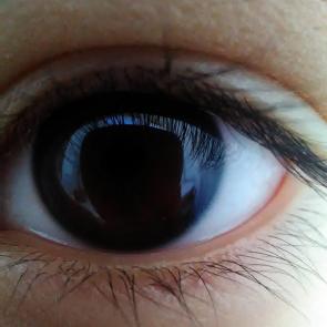 : My eye